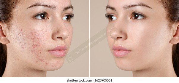 Skin retouch